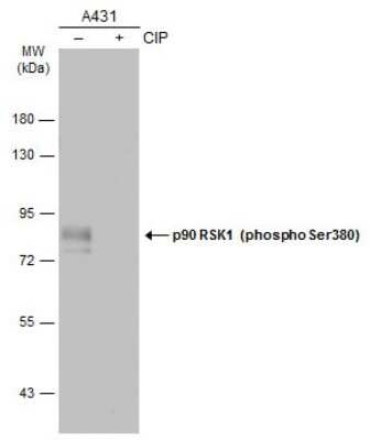 Western Blot: RSK1 [p Ser380] Antibody [NBP3-13243]